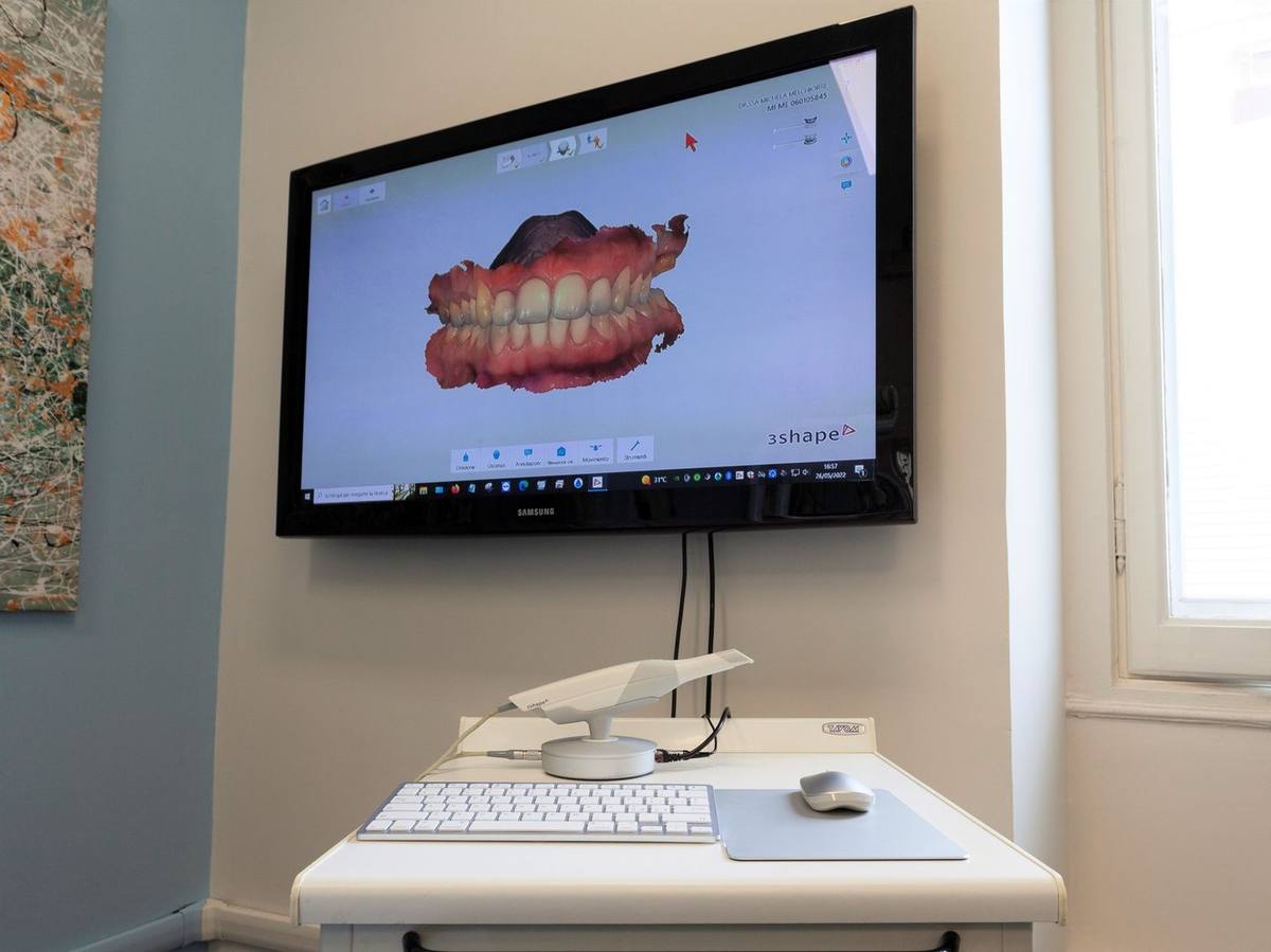 Il monitor con la scansione digitale dei denti e lo scanner